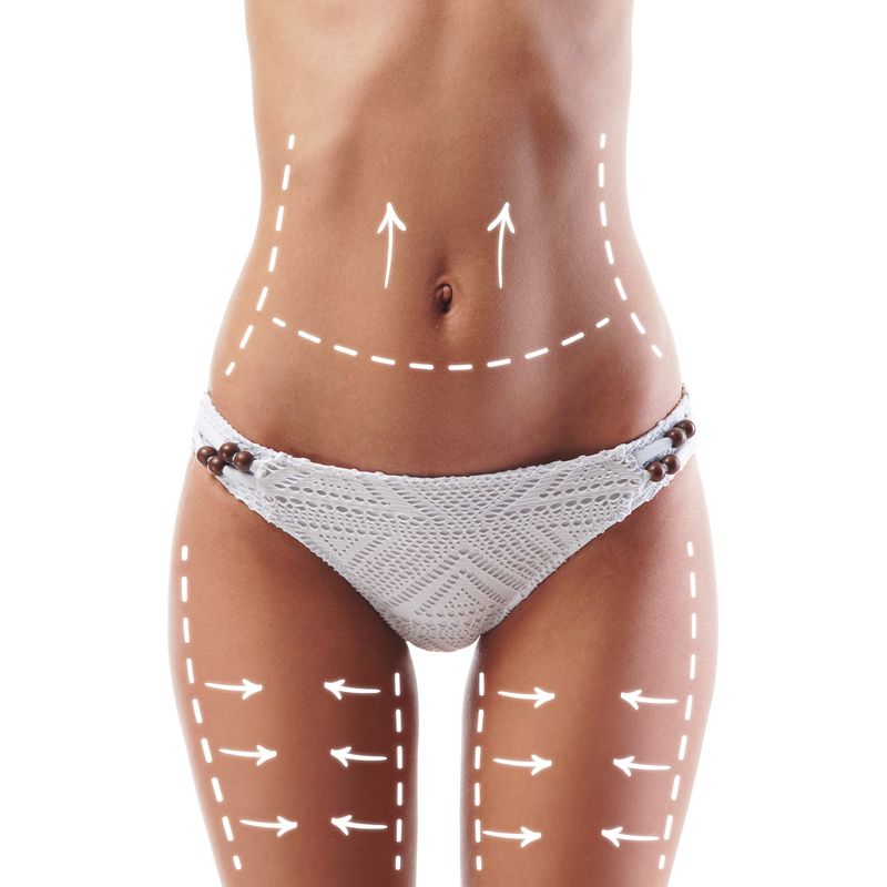 Liposuction (5+ body areas)